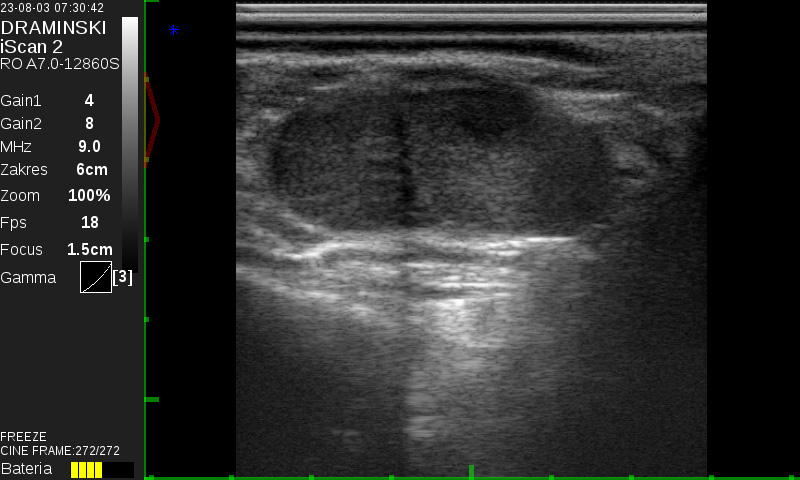 Figure 2: Corpus Luteum and Follicles on the Ovary