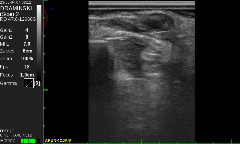 Figure 1: Ovarian Afunction